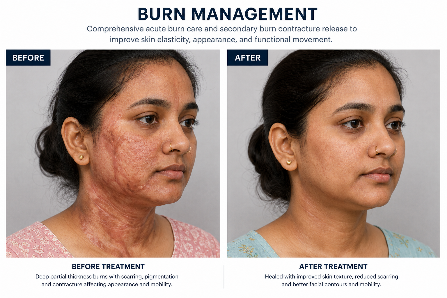 Reconstructive Surgery Results 2