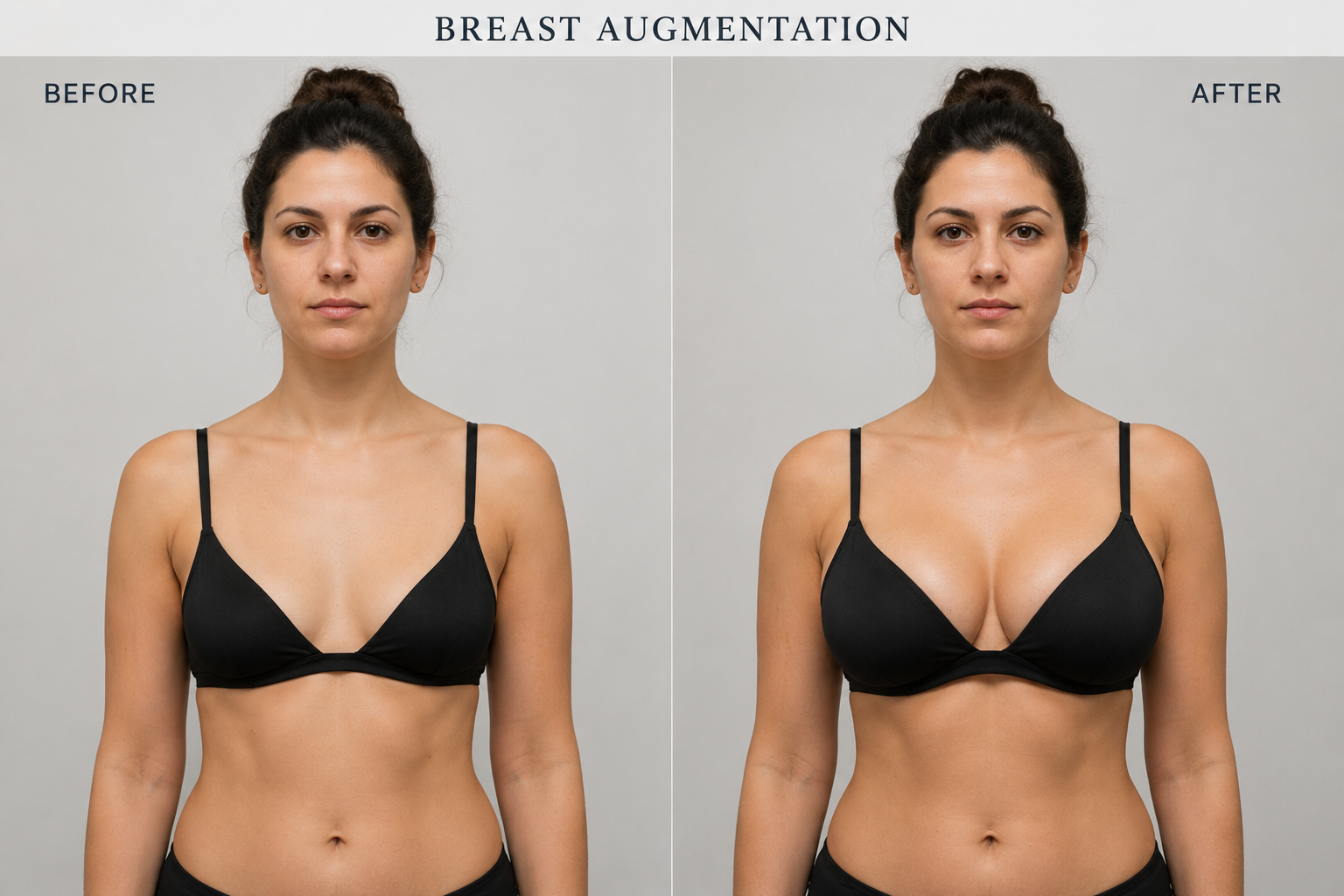 Breast Aesthetics Result 1