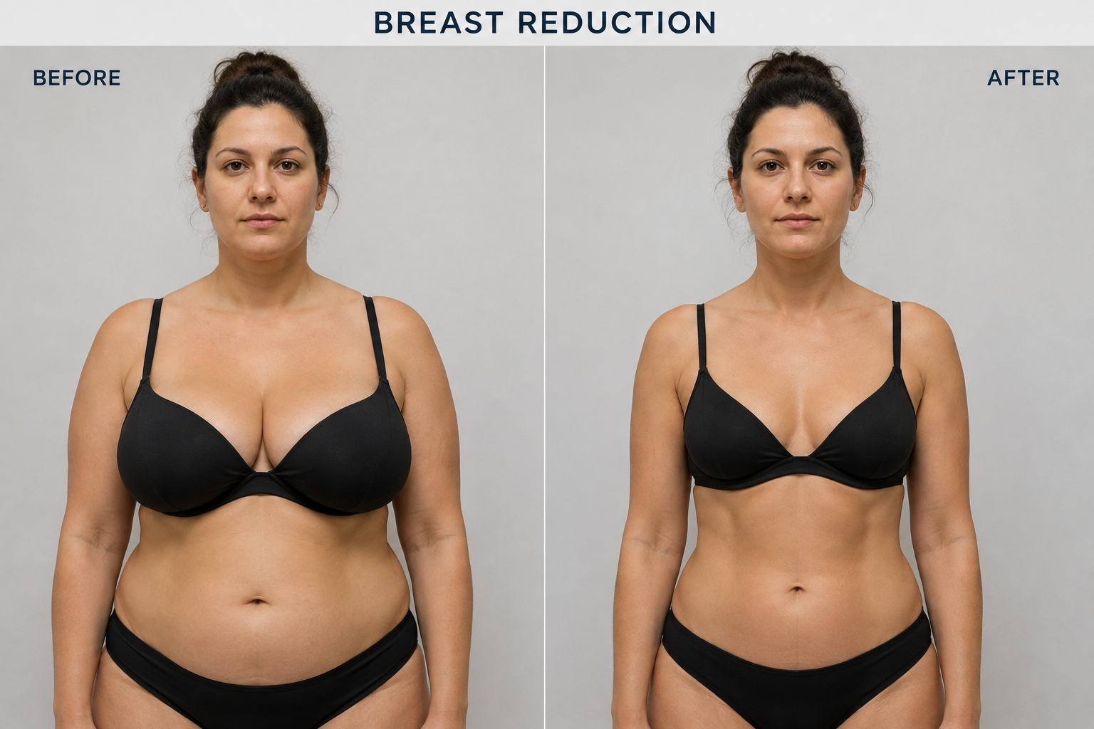 Breast Aesthetics Result 2