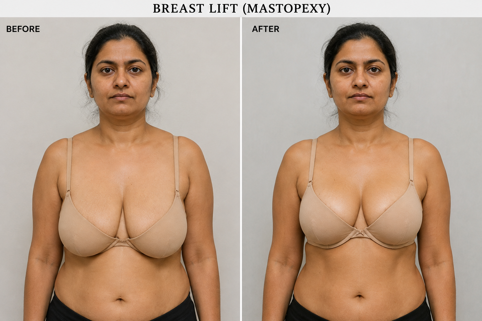 Breast Aesthetics Result 3