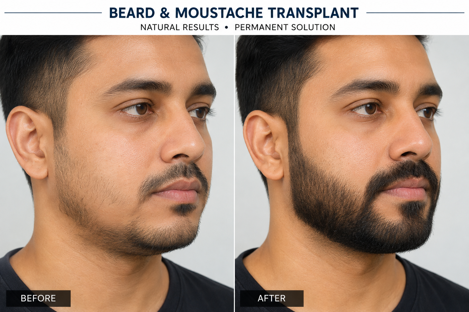 Hair Restoration Result 1